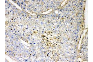 Immunohistochemistry (IHC) image for anti-Guanine Nucleotide Binding Protein (G Protein), beta Polypeptide 1 (GNB1) (AA 2-42), (N-Term) antibody (ABIN4886607)