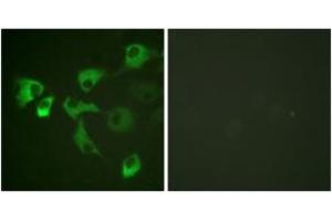 Immunofluorescence analysis of HuvEc cells, using eEF2 (Phospho-Thr56) Antibody. (EEF2 Antikörper  (pThr56))