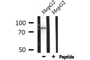 Western blot analysis of extracts from HepG2, using ZBTB17 Antibody. (ZBTB17 Antikörper  (Internal Region))