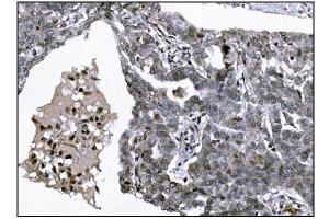 IHC analysis of KMT1B/SUV39H2 using anti-KMT1B/SUV39H2 antibody (ABIN7602135). (SUV39H2 Antikörper  (AA 6-410))