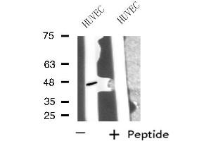 Western blot analysis of extracts from HUVEC cells, using PPP1R7 antibody. (PPP1R7 Antikörper  (C-Term))