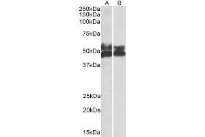 Western Blotting (WB) image for anti-Fc Receptor-Like 1 (FCRL1) antibody (ABIN5900721) (FCRL1 Antikörper)