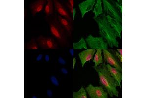 ABIN6259347 and ABIN6275551 staining  cells by IF/ICC. (PPP4R1L Antikörper  (C-Term))