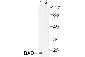 Image no. 1 for anti-BCL2-Associated Agonist of Cell Death (BAD) antibody (ABIN265323) (BAD Antikörper)