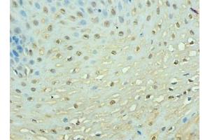 Immunohistochemistry of paraffin-embedded human esophageal tissue using  at dilution of 1: 100 (TEP1 Antikörper  (AA 2-226))