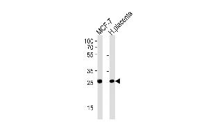 PRLR Antibody (Center) (ABIN1881684 and ABIN2843621) western blot analysis in MCF-7 cell line and human placenta tissue lysates (35 μg/lane). (Prolactin Receptor Antikörper  (AA 147-179))