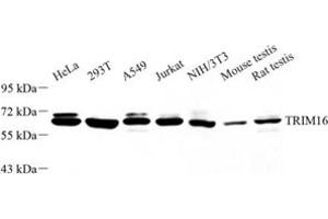 Western blot analysis of TRIM16 (ABIN7076012) at dilution of 1: 1000 (TRIM16 Antikörper)