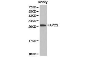 Western Blotting (WB) image for anti-Amyloid P Component, Serum (APCS) antibody (ABIN1871016)