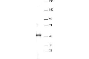 Western blot of ERR-a antibody. (SLC7A1 Antikörper  (C-Term))