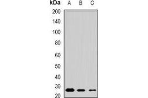 Western blot analysis of MSRB3 expression in mouse testis (A), mouse brain (B), rat lung (C) whole cell lysates. (MSRB3 Antikörper)