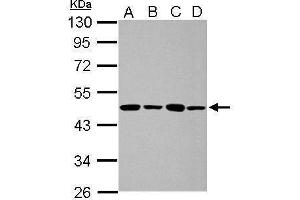 WB Image Sample (30 ug of whole cell lysate) A: 293T B: A431 C: HeLa D: HepG2 10% SDS PAGE antibody diluted at 1:1000 (PPME1 Antikörper)