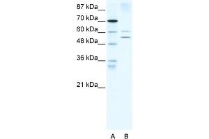 WB Suggested Anti-AIRE Antibody   Titration: 5 ug/ml   Positive Control: HepG2 Whole Cell (AIRE Antikörper  (N-Term))