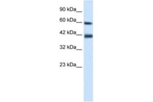 Western Blotting (WB) image for anti-Tripartite Motif Containing 31 (TRIM31) antibody (ABIN2461032) (TRIM31 Antikörper)