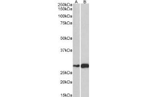 ABIN570906 (1µg/ml) staining of Mouse (A) and Rat (B) Skeletal Muscle lysate (35µg protein in RIPA buffer). (ATF5 Antikörper  (C-Term))