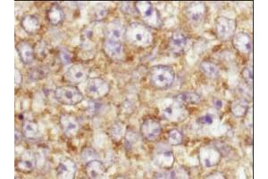 Immunohistochemistry. (AKT1 Antikörper  (C-Term))