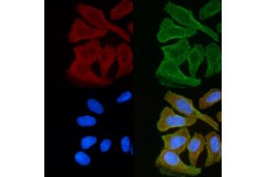ABIN6255420 and ABIN6268978 staining Hela cells(30 min of UV treatment) by IF/ICC. (LCK Antikörper  (pSer59))