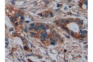 Immunohistochemistry (IHC) image for anti-Disrupted in Schizophrenia 1 (DISC1) (AA 102-261) antibody (ABIN7439720)