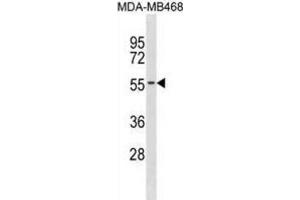 Western Blotting (WB) image for anti-Potassium Channel Subfamily K Member 6 (KCNK6) antibody (ABIN3001021) (KCNK6 Antikörper)