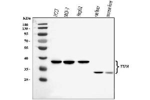 Western blot analysis of TTPA/TPP1 using anti-TTPA/TPP1 antibody (ABIN7599931).