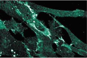 Immunofluorescence staining of human fibroblasts. (HNRNPU Antikörper  (AA 326-632))