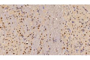 Detection of LXRb in Mouse Cerebellum Tissue using Polyclonal Antibody to Liver X Receptor Beta (LXRb)