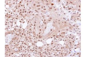 Immunohistochemistry (IHC) image for anti-Valosin Containing Protein (VCP) (N-Term) antibody (ABIN2856882)