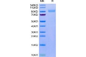 Mouse LRRN1 on Tris-Bis PAGE under reduced condition. (LRRN1 Protein (AA 26-631) (His tag))