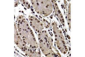 Immunohistochemistry of paraffin-embedded human stomach using GPS1 antibody at dilution of 1:100 (x400 lens). (GPS1 Antikörper)