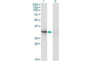 Western Blot analysis of CDK2 expression in transfected 293T cell line by CDK2 monoclonal antibody (M01A), clone 3A2-3G6. (CDK2 Antikörper  (AA 1-298))