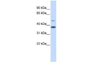 Western Blotting (WB) image for anti-Methylmalonic Aciduria (Cobalamin Deficiency) CblD Type, with Homocystinuria (MMADHC) (Middle Region) antibody (ABIN631034)