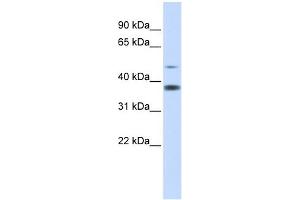 C2ORF25 antibody used at 1 ug/ml to detect target protein. (MMADHC Antikörper  (Middle Region))