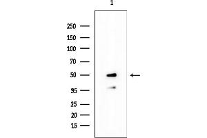 anti-GATA Binding Protein 1 (Globin Transcription Factor 1) (GATA1) (pSer310) antibody