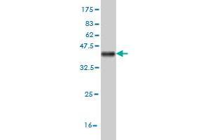 Western Blot detection against Immunogen (36. (DKK1 Antikörper  (AA 81-180))