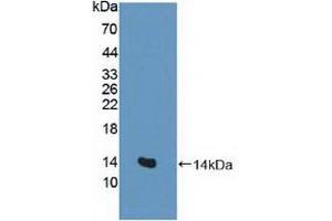 Figure. (SLC1A1 Antikörper  (AA 115-209))