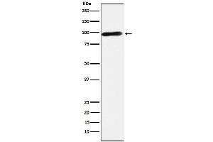 Western blot analysis of Calmegin expression in Jurkat cell lysate. (Rekombinanter Calmegin Antikörper)