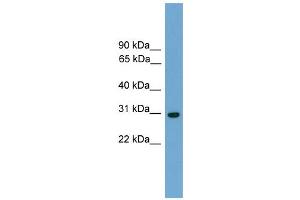WB Suggested Anti-Tcea1 Antibody Titration:  0. (TCEA1 Antikörper  (N-Term))
