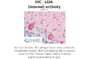 Image no. 1 for anti-Leucine-Rich Repeat LGI Family, Member 4 (LGI4) (Internal Region) antibody (ABIN1736431)