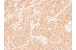 Formalin-fixed, paraffin-embedded human Adrenal stained with Adipophilin Mouse Monoclonal Antibody (ADFP/1366). (ADRP Antikörper  (AA 249-376))