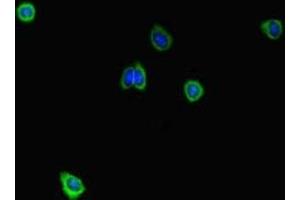 Immunofluorescent analysis of HepG2 cells using ABIN7168626 at dilution of 1:100 and Alexa Fluor 488-congugated AffiniPure Goat Anti-Rabbit IgG(H+L) (STIL Antikörper  (AA 388-637))