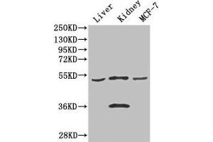 Western Blot Positive WB detected in: Mouse liver tissue, Mouse kidney tissue, MCF-7 whole cell lysate All lanes: CDSN antibody at 3 μg/mL Secondary Goat polyclonal to rabbit IgG at 1/50000 dilution Predicted band size: 52 kDa Observed band size: 52, 36 kDa (Corneodesmosin Antikörper  (AA 40-229))