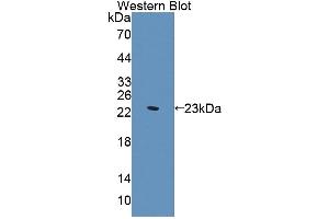 Detection of Recombinant SVIL, Human using Polyclonal Antibody to Supervillin (SVIL) (Supervillin Antikörper  (AA 1385-1525))