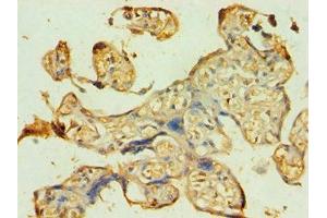 Immunohistochemistry of paraffin-embedded human placenta tissue using ABIN7145118 at dilution of 1:100 (ATG9B Antikörper  (AA 715-924))