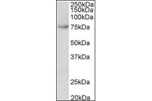 FUBP1 Antibody Cat. (FUBP1 Antikörper  (Internal Region))