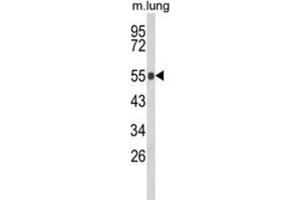 Western Blotting (WB) image for anti-Gc antibody (ABIN3003972) (Gc Antikörper)