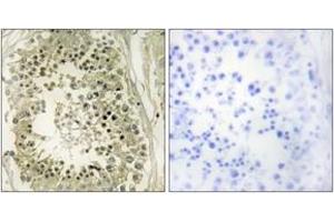 Immunohistochemistry analysis of paraffin-embedded human testis tissue, using HGS Antibody. (HGS Antikörper  (AA 451-500))