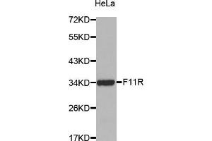 Western Blotting (WB) image for anti-F11 Receptor (F11R) (AA 30-238) antibody (ABIN6216028) (F11R Antikörper  (AA 30-238))