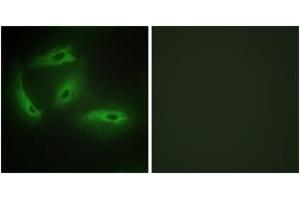 Immunofluorescence analysis of HeLa cells, using CDKL4 Antibody. (CDKL4 Antikörper  (AA 266-315))