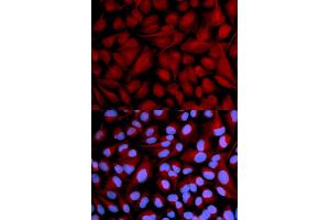 Immunofluorescence analysis of U2OS cells using CASK antibody (ABIN5971336). (CASK Antikörper)