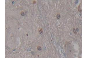 IHC-P analysis of Rat Spinal cord Tissue, with DAB staining. (CDNF Antikörper  (AA 20-183))