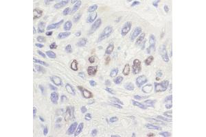 Immunohistochemistry (IHC) image for anti-Topo IIalpha (C-Term) antibody (ABIN7454588) (Topo IIalpha (C-Term) Antikörper)